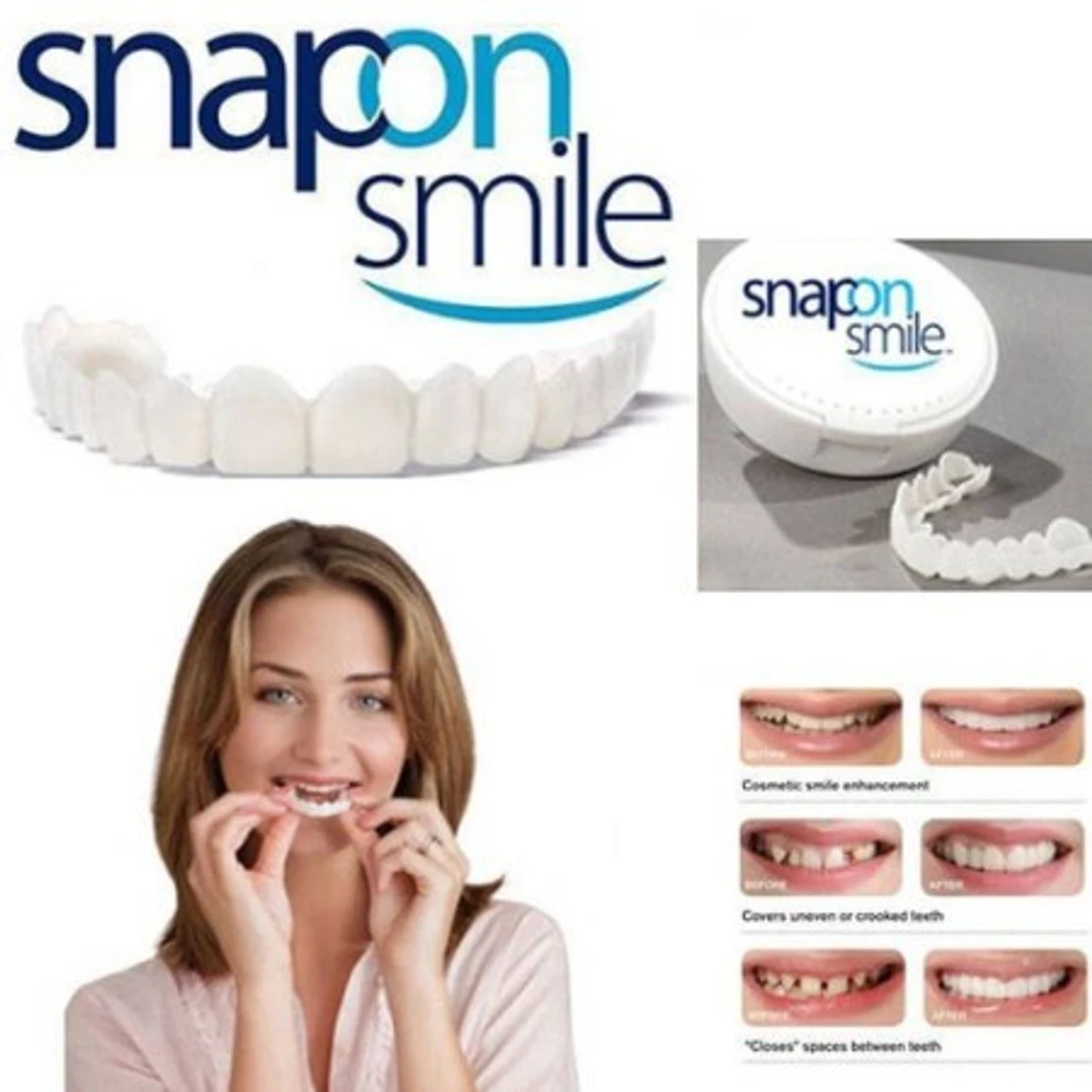 1 Pair Teeth ( 2 pcs) Veneers Whitening Dentures Imitation Braces Temporary False Teeth Cover Perfect Smile Comfortable Fit Denture Kit